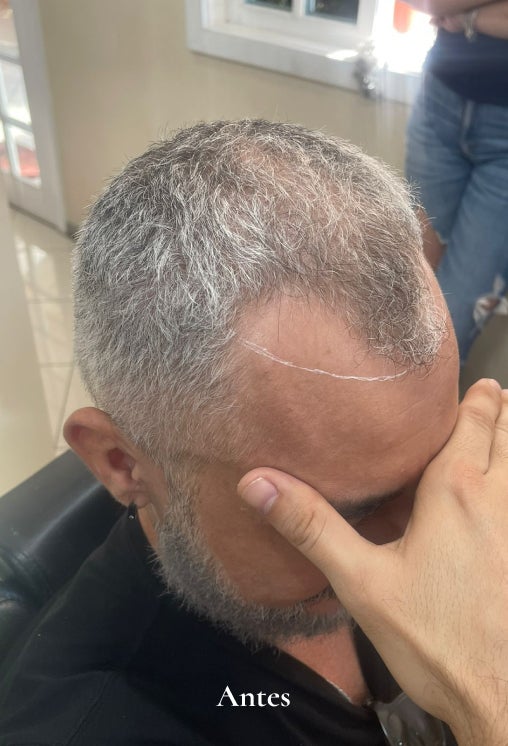 Barbearia e Prótese Capilar em Vitória ES