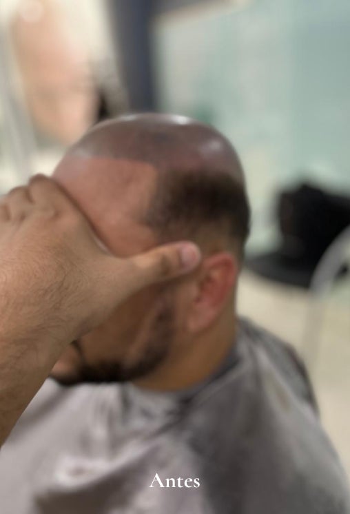 Barbearia e Prótese Capilar em Vitória ES